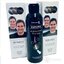 REPAREX pre mužov (Akcia) proti šedinám 2x125 ml + šampón na lupiny 200 ml, 1x1 set obrázok