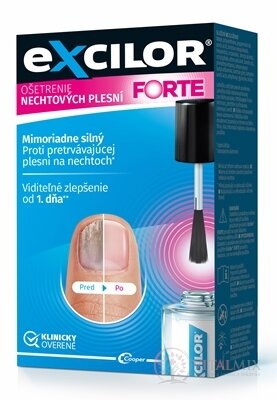 Excilor FORTE lak pro léčbu plísňových infekcí nehtů 1x30 ml